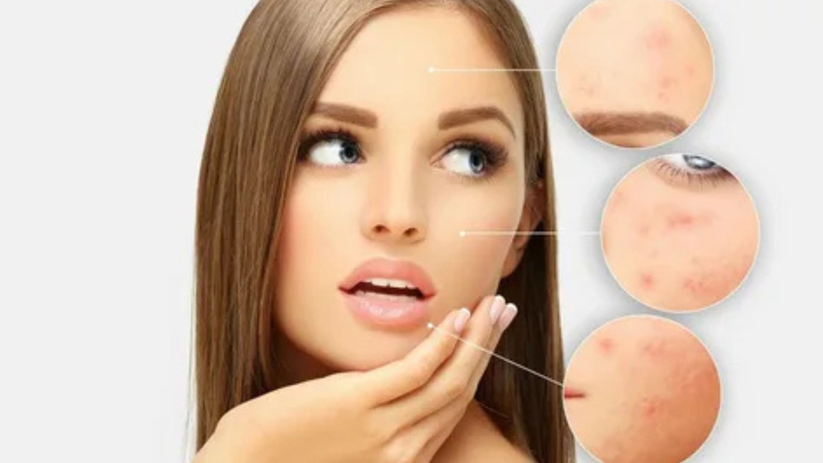Dermal fillers in Chandigarh