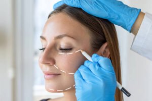 Are Facelifts Right for Your Facial Rejuvenation Goals