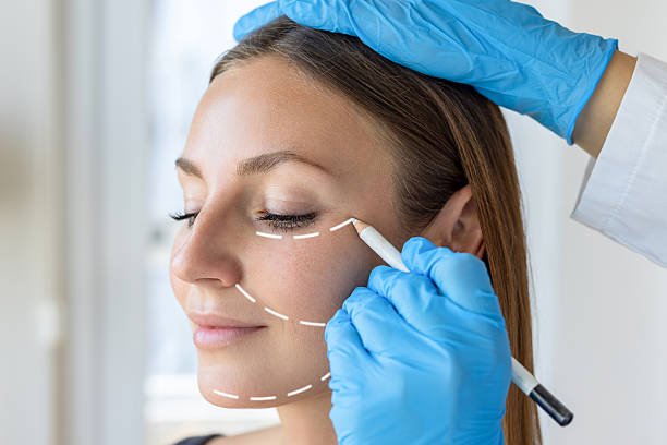 Are Facelifts Right for Your Facial Rejuvenation Goals