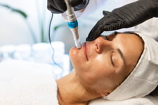 Can Dermapen Microneedling Reduce Forehead Fine Lines