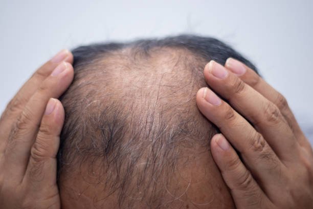 Can GFC Treatment for Hair Help Repair Damaged Hair