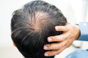 Can GFC Treatment for Hair improve hair thickness