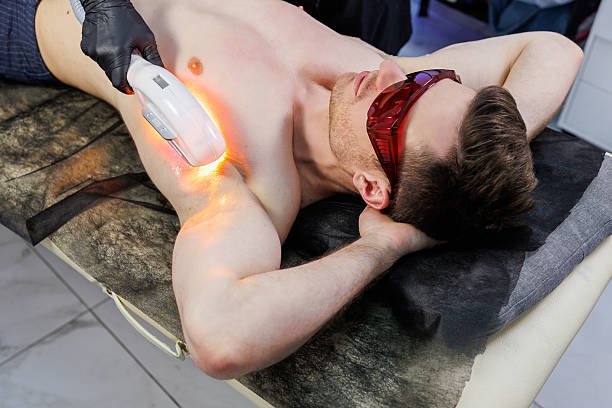 Can Men’s Laser Hair Removal reduce underarm hair