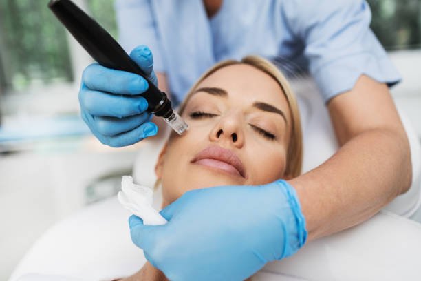 Can Microneedling Improve Skin Elasticity
