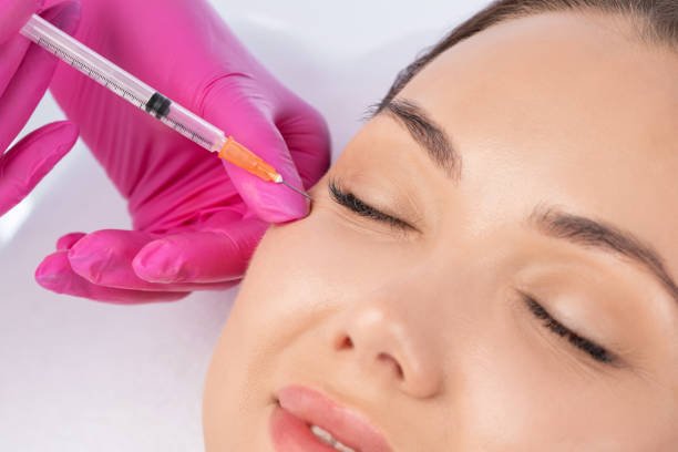 Can Under Eye Fillers soften fine lines