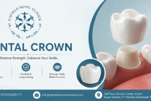 Dental Crown in Islamabad
