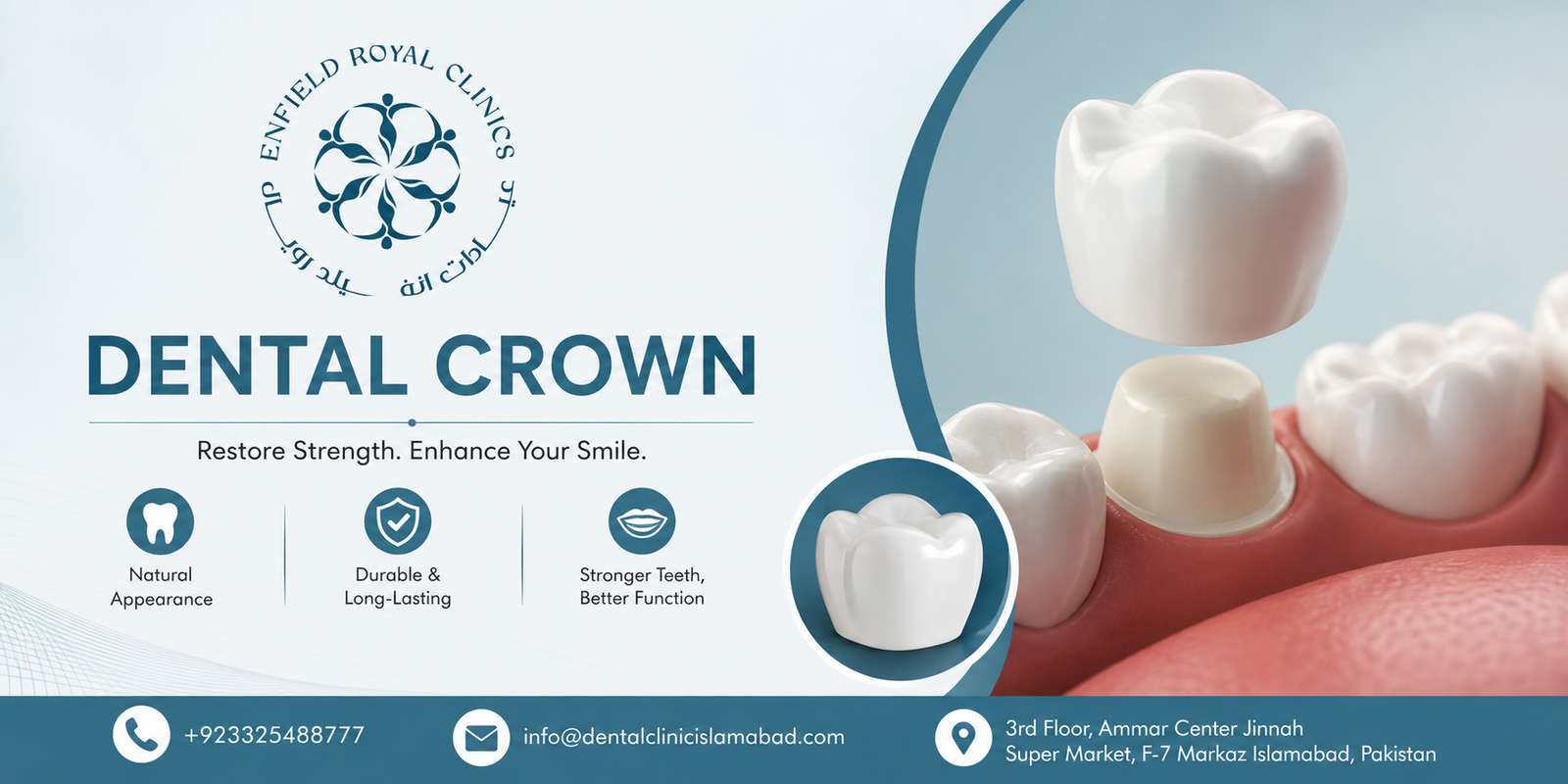 Dental Crown in Islamabad