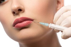 Do Russian Lip Fillers work for naturally thin lips