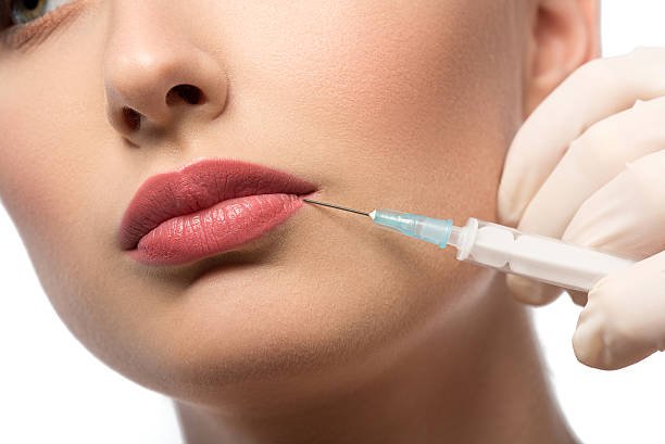 Do Russian Lip Fillers work for naturally thin lips