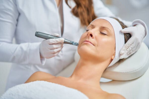 Does Dermapen Treatment Reduce Skin Roughness