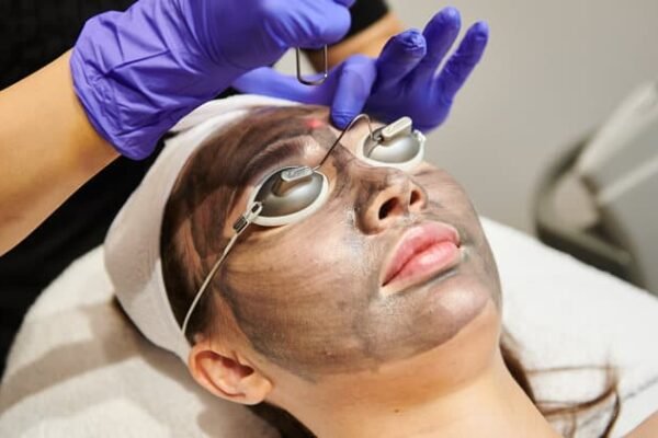 Laser Carbon Peel Abu Dhabi