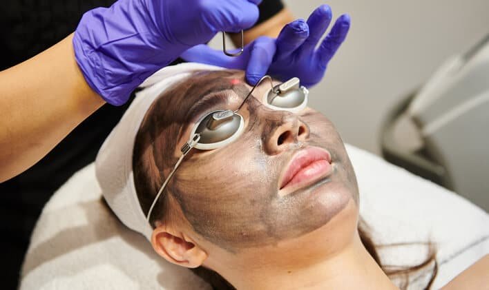 Laser Carbon Peel Abu Dhabi