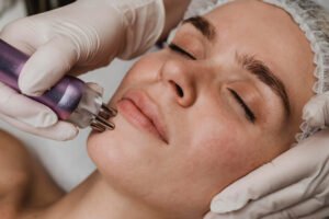 Laser Skin Resurfacing Abu Dhabi