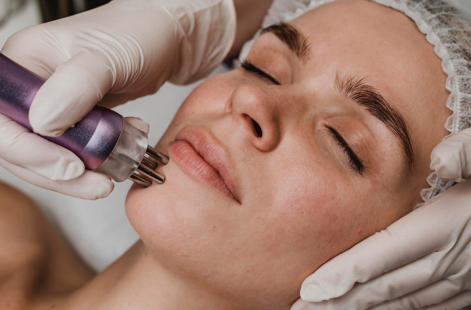 Laser Skin Resurfacing Abu Dhabi