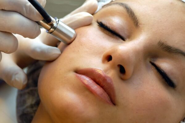 Microdermabrasion treatment Abu Dhabi