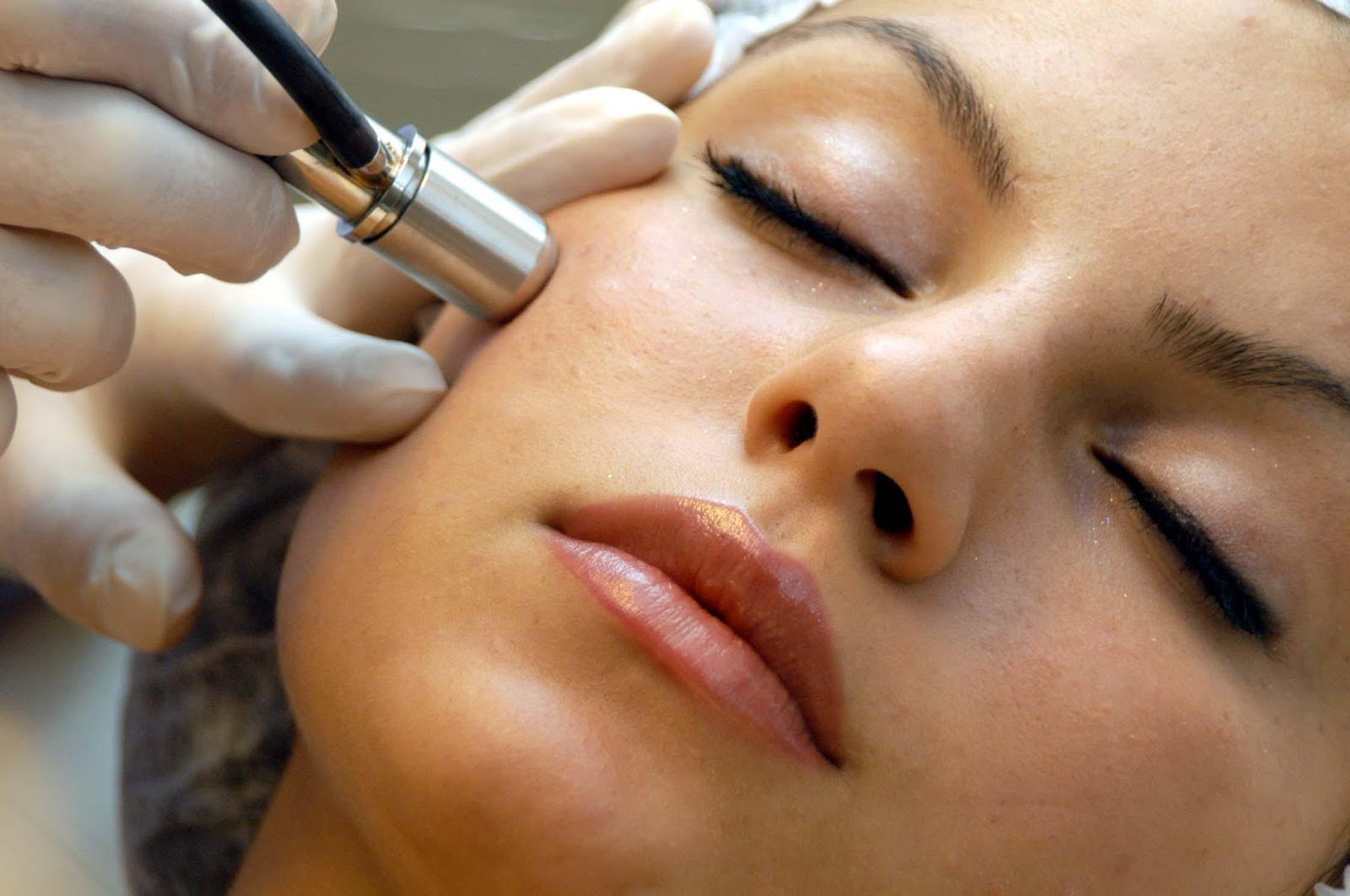 Microdermabrasion treatment Abu Dhabi