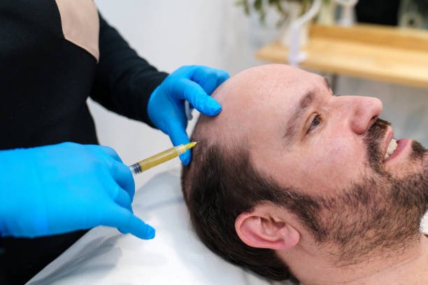 Does PRP Hair Treatment work for genetic hair loss