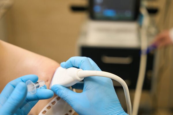 PRP injections for knees Abu Dhabi