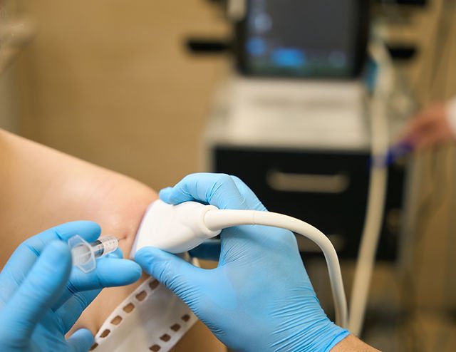 PRP injections for knees Abu Dhabi