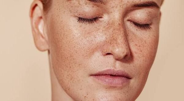 Does Pigmentation Treatment Need Multiple Sessions