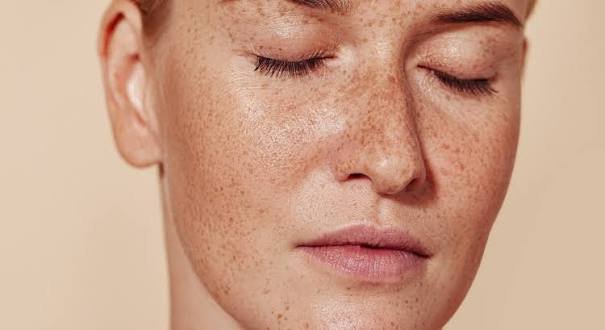 Does Pigmentation Treatment Need Multiple Sessions