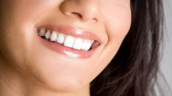 Does Teeth Whitening work on naturally yellow teeth