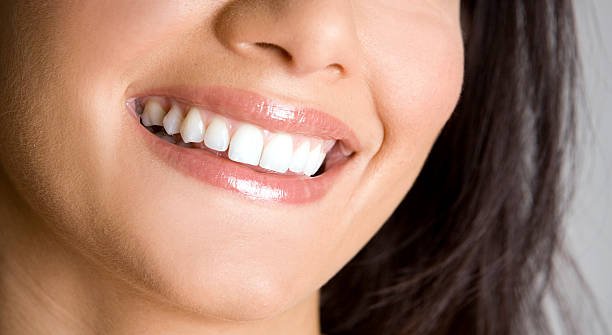 Does Teeth Whitening work on naturally yellow teeth