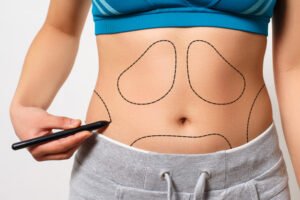 Tummy Tuck Abu Dhabi