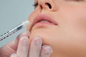 Lip Filler Abu Dhabi
