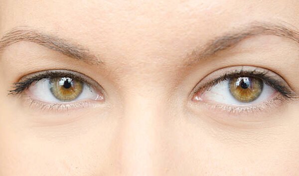 Is Dark Circles Treatment Safe for Sensitive Skin
