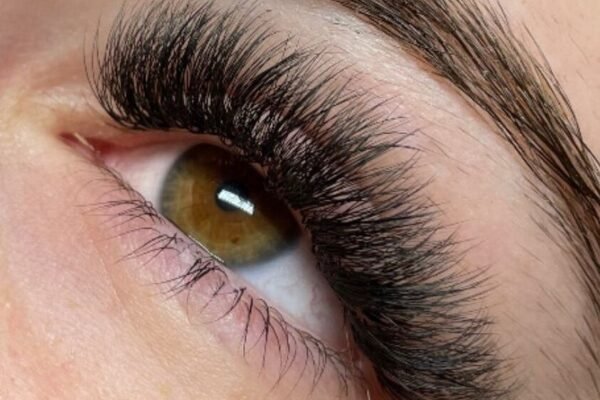 Eyelash Hair Transplant in Abu Dhabi