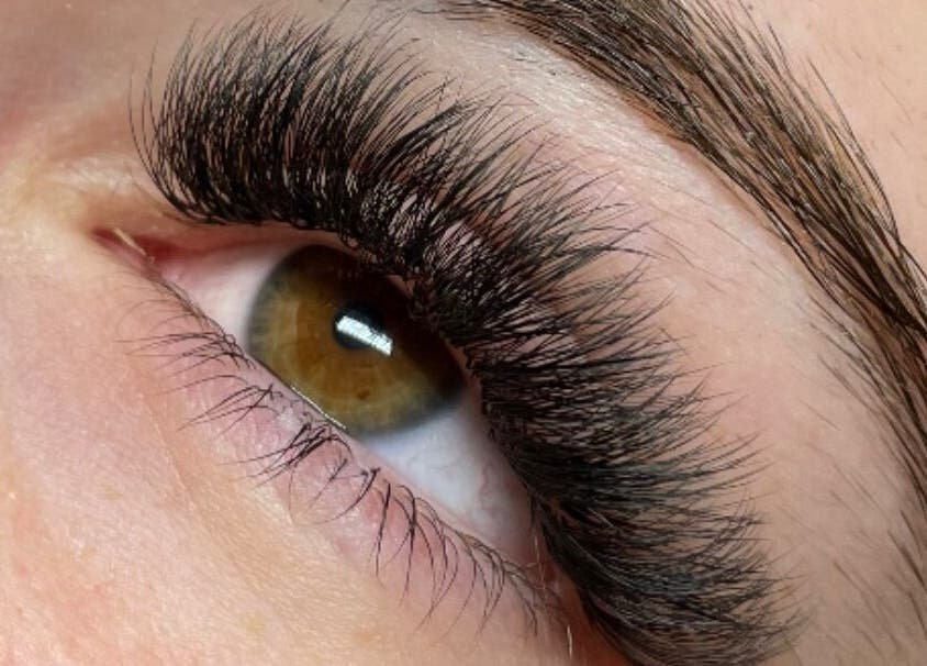 Eyelash Hair Transplant in Abu Dhabi
