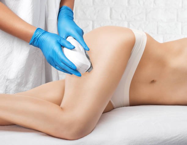 Is Full Body Laser Hair Removal Cost fixed per session