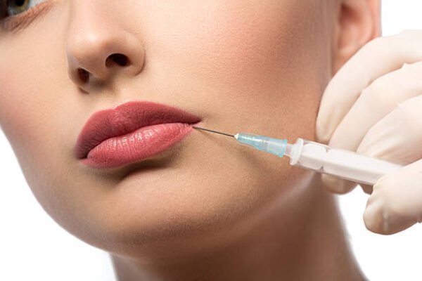 Is Lip Fillers Injection Suitable for All Ages