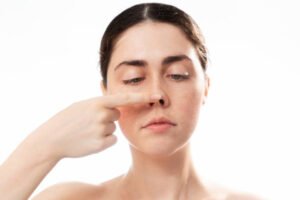 Is Rhinoplasty Safe for Correcting Nose Deformities