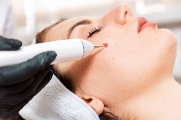 Skin Lesion Removal Abu Dhabi