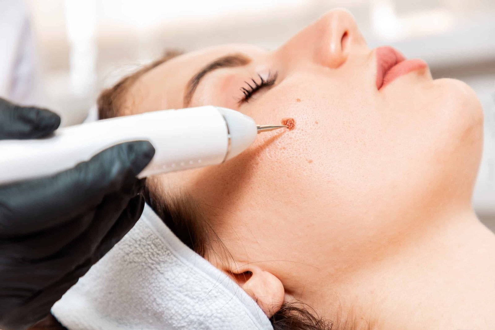 Skin Lesion Removal Abu Dhabi