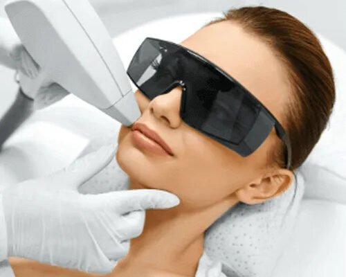 laser hair removal Edmonton