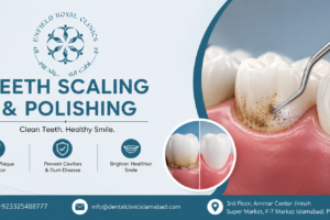 Teeth Scaling and Polishing in Islamabad
