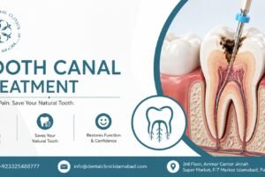 Tooth Canal Treatment in Islamabad