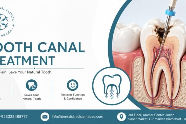 Tooth Canal Treatment in Islamabad