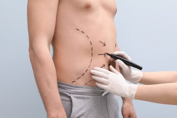 Fat Removal