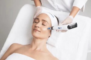 microneedling Edmonton