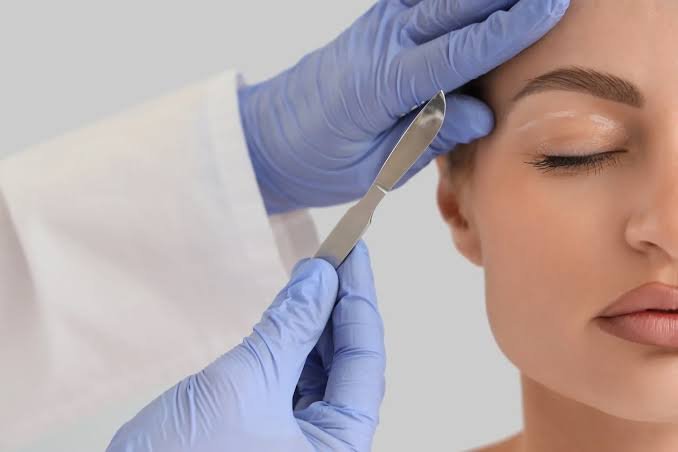 Blepharoplasty in Dubai