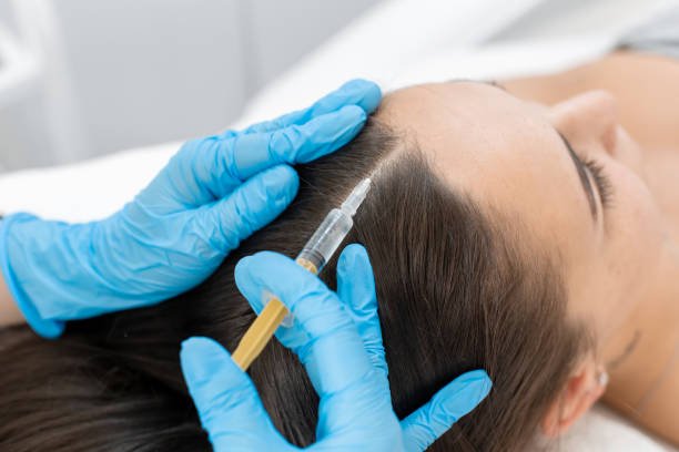 Can Best PRP Hair Treatment improve scalp health