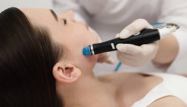 Can Face Rejuvenation help with mild skin pigmentation