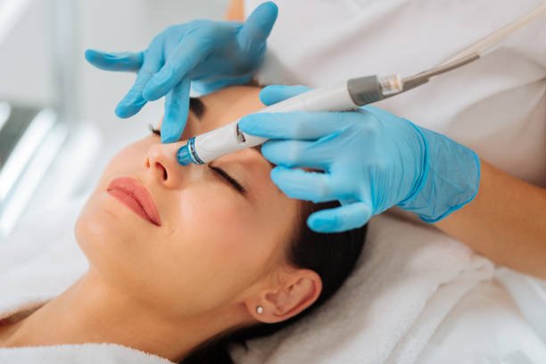 Can HydraFacial improve congested pores around the nose