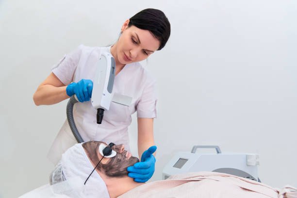 Can Laser Carbon Peel improve facial skin radiance