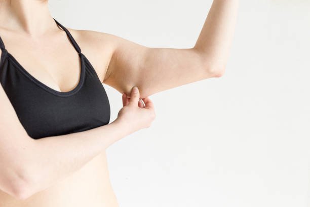 Can Liposuction Help Sculpt the Arms and Legs