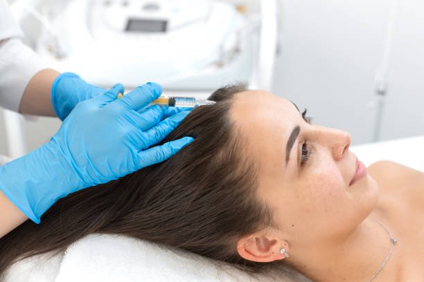 Can PRP Hair Treatment Improve Scalp Health Naturally